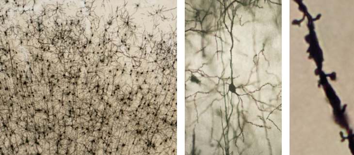 Three photographs of neurons, each image at a higher magnification than the previous. The image background is brown. Cell bodies are black and ovular. Dendritic branches look like sinuous lines extending from each cell body. Left panel: Lowest magnification. Approximately 200 neurons are shown. Neurons in the lower portion of the image are densely packed. A long dendrite extends from the top of each neuron, in parallel with those from neighboring neurons. Dendrites at the base of each neuron extend in all directions, overlapping with those from neighboring neurons. Neurons in the upper portion are less densely packed, and have fewer dendritic branches that extend from all sides of the cell body. Middle panel: Higher magnification. A single neuron is shown. The neuron looks similar to those in the lower portion of the left panel. Right panel: Highest magnification. A segment of a single dendrite is shown. Small bumps and short mushroom-shaped projections (dendritic spines) cover the surface of the dendrite. 