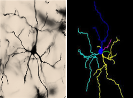 A photograph of a neuron (left panel) is shown next to an illustration of the same neuron (right panel). Left panel: The image background is brown. A single neuron is shown. The cell body is black and ovular, and dendritic branches look like sinuous lines extending from the cell body. A single dendrite extends from the top of the cell body, and multiple dendrites extend from the base. Right panel: A multicolor illustration of the neuron pictured in the left panel. The image background is black. The cell body and each dendritic tree is shown in a different color (dark blue, light blue, pink, green, and yellow). Parts of the dendritic tree that were out of focus in the left panel are clearly reconstructed in the right panel; the size and shape of each dendrite is otherwise identical between the two panels.