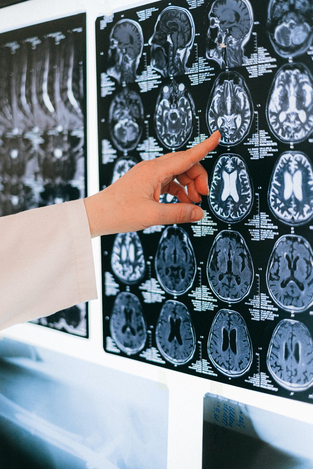 Image showing a doctor pointing to a brain scan generated by an MRI machine.