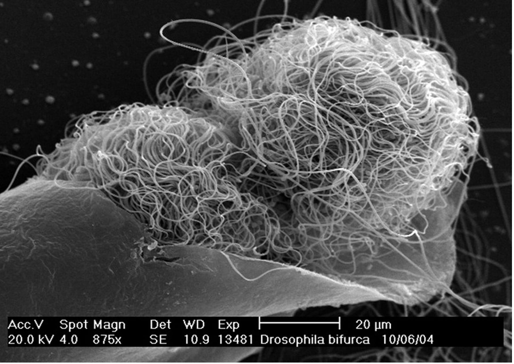 [Two large sperm cells are coiled up next to each other within a male’s testis (photo by Romano Dallai).]