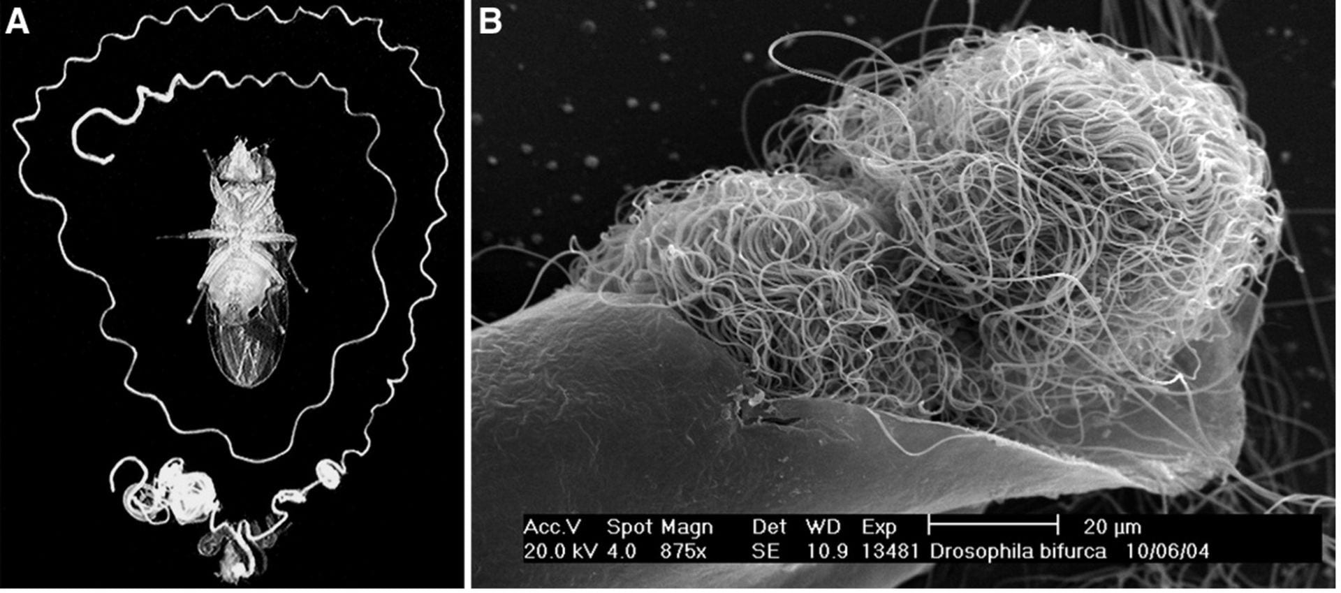 On the left, a photo of Drosophila bifurca with its long dissected testis unfurling around its body multiple times (photo by Scott Pitnick). On the right, two large D. bifurca sperm cells are coiled up tightly into balls within a male’s testis (photo by Romano Dallai).